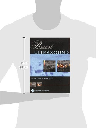 Breast Ultrasound (Hardcover) — additional view