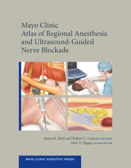 Mayo Clinic Atlas of Regional Anesthesia and Ultrasound-Guided Nerve Blockade (Mayo Clinic Scientific Press) [Hardcover] James R. Hebl; Robert L. Lennon and John V. Hagen