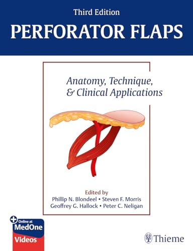 Perforator Flaps: Anatomy, Technique, & Clinical Applications (Hardcover)