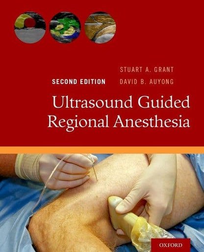 Ultrasound Guided Regional Anesthesia [Paperback] Auyong, David B. and Grant, Stuart A.