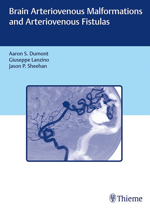 Brain Arteriovenous Malformations and Arteriovenous Fistulas [Hardcover] Dumont, Aaron S.; Lanzino, Giuseppe and Sheehan, Jason P