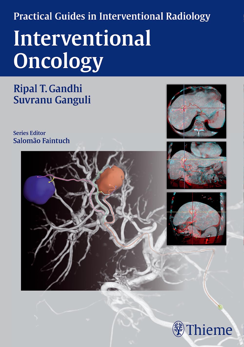 Interventional Oncology (Practical Guides in Interventional Radiology) [Hardcover] Gandhi, Ripal and Ganguli, Suvranu