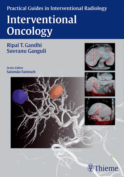 Interventional Oncology (Practical Guides in Interventional Radiology) [Hardcover] Gandhi, Ripal and Ganguli, Suvranu