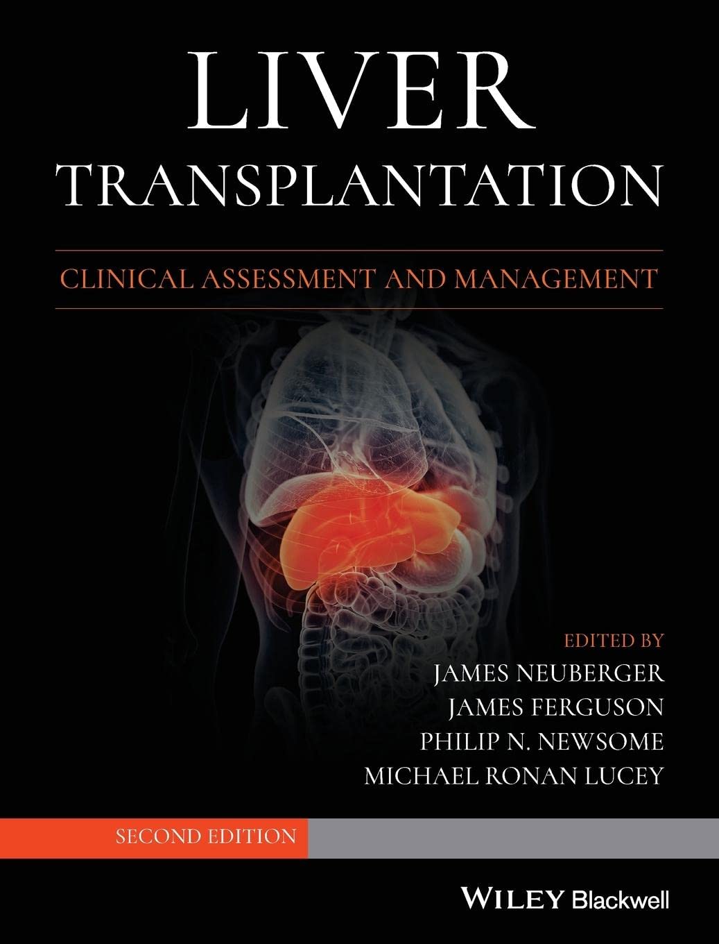 Liver Transplantation: Clinical Assessment and Management [Hardcover] Neuberger, James; Ferguson, James; Newsome, Philip N. and Lucey, Michael R.
