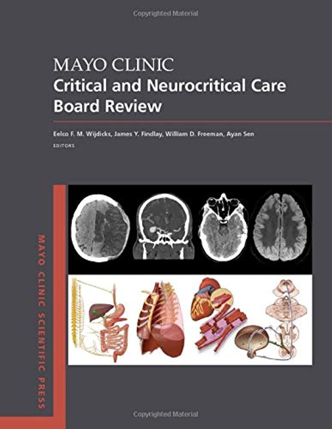 Mayo Clinic Critical and Neurocritical Care Board Review (Mayo Clinic Scientific Press) [Paperback] Wijdicks MD  PhD, Eelco F.M.; Findlay MB ChB, James Y.; Freeman MD  FNCS, William D. and Sen MD  MSc  FCCP  FACEP, Ayan