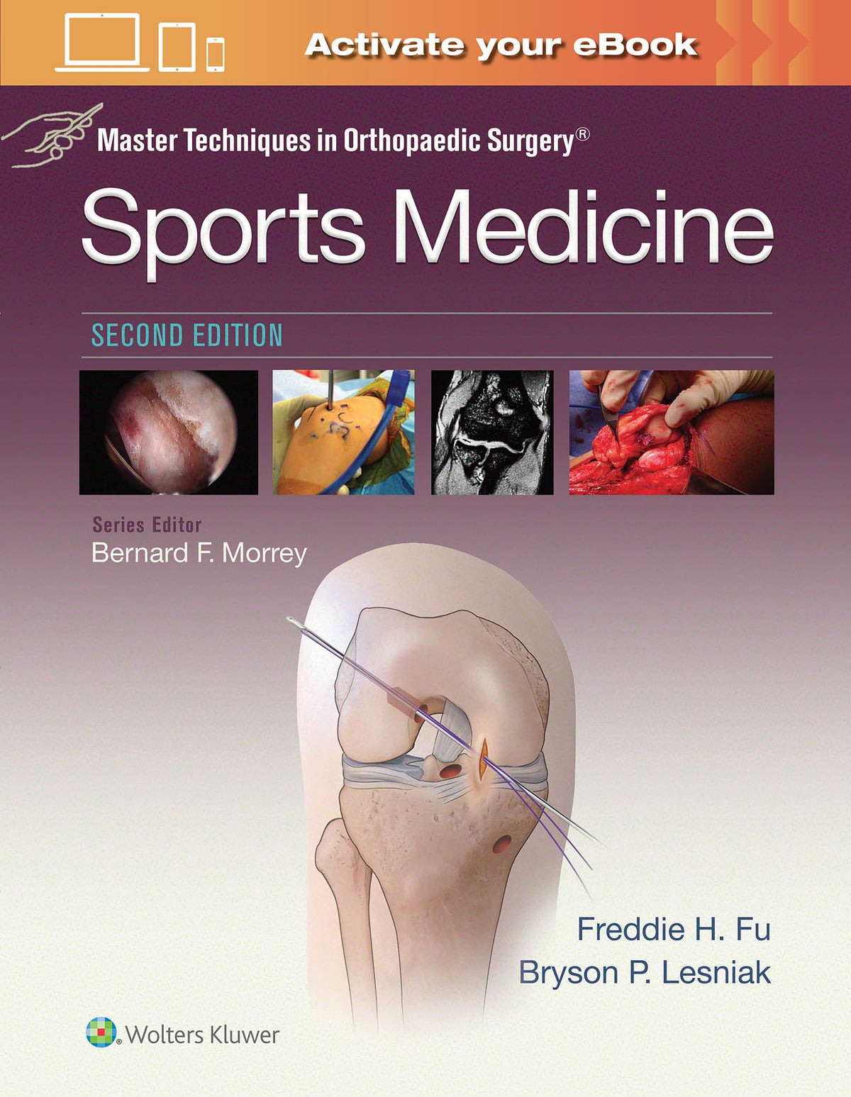 Master Techniques in Orthopaedic Surgery: Sports Medicine — Second Edition (Hardcover)
