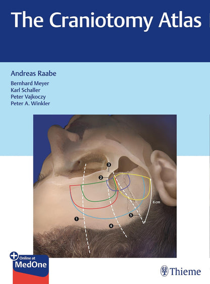 The Craniotomy Atlas [Hardcover] Raabe, Andreas