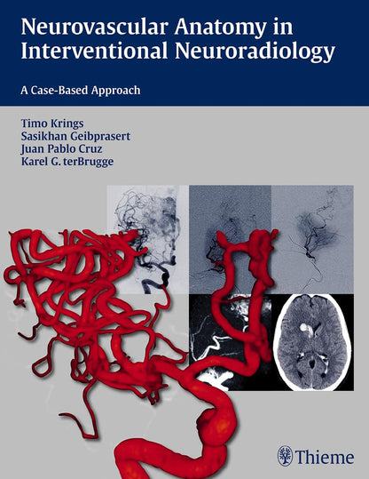 Neurovascular Anatomy in Interventional Neuroradiology: A Case-Based Approach [Paperback] Krings, Timo; Geibprasert, Sasikhan; Cruz, Juan Pablo and ter Brugge, Karel