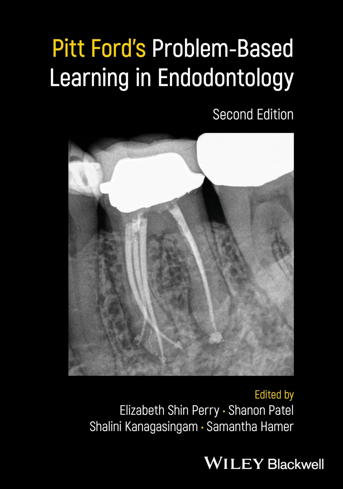 Pitt Ford's Problem-Based Learning in Endodontology [Paperback] Perry, Elizabeth Shin; Patel, Shanon; Kanagasingam, Shalini and Hamer, Samantha