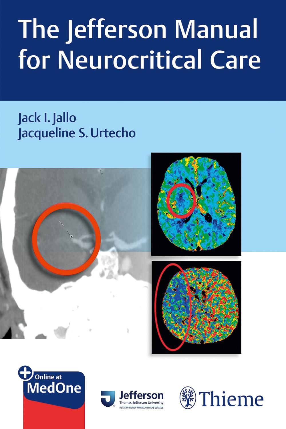 The Jefferson Manual for Neurocritical Care [Paperback] Jallo, Jack I. and Urtecho, Jacqueline
