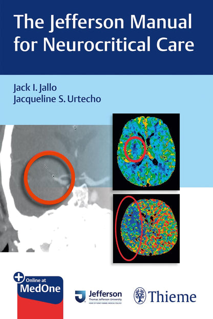 The Jefferson Manual for Neurocritical Care [Paperback] Jallo, Jack I. and Urtecho, Jacqueline