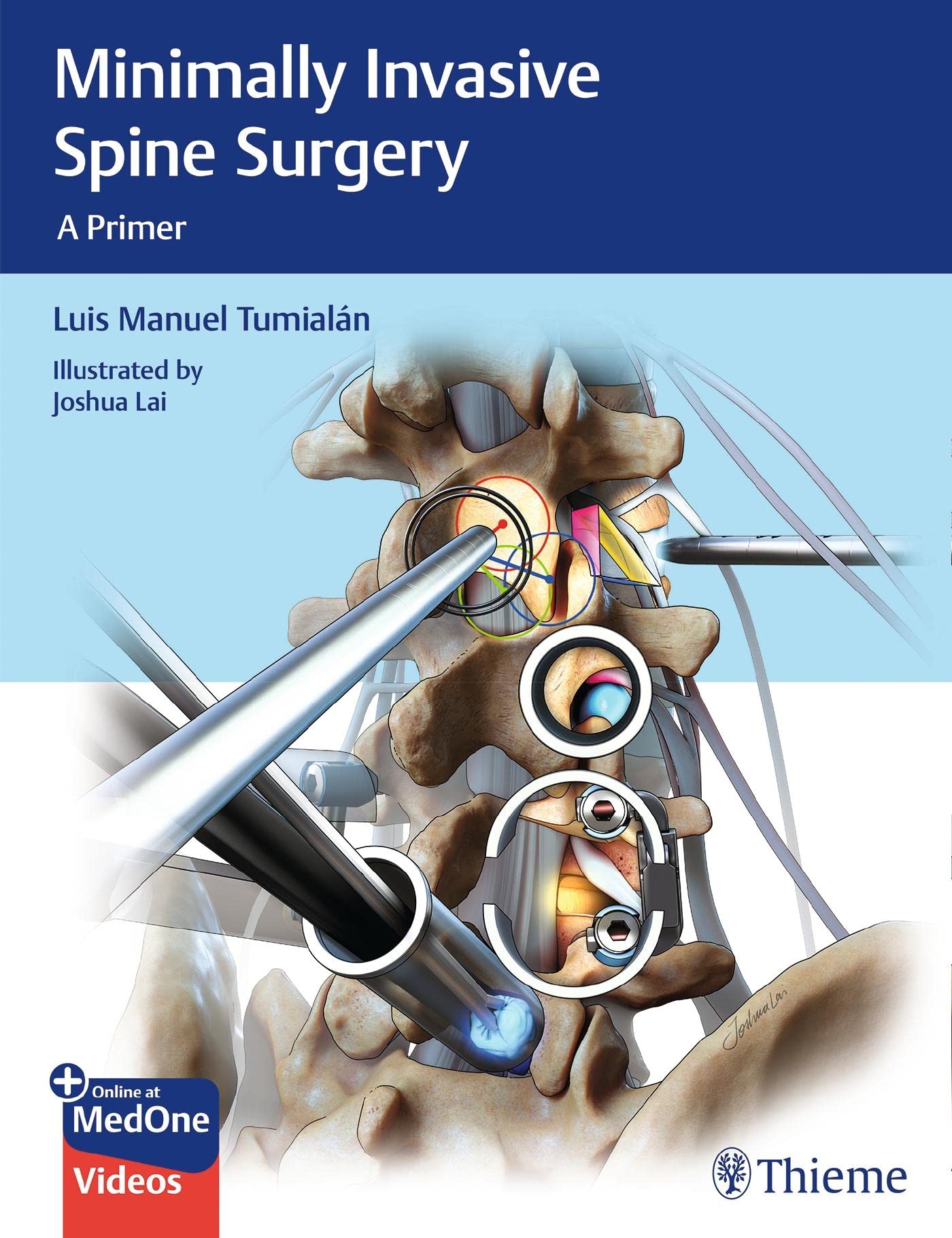 Minimally Invasive Spine Surgery: A Primer [Hardcover] Tumialan, Luis Manuel