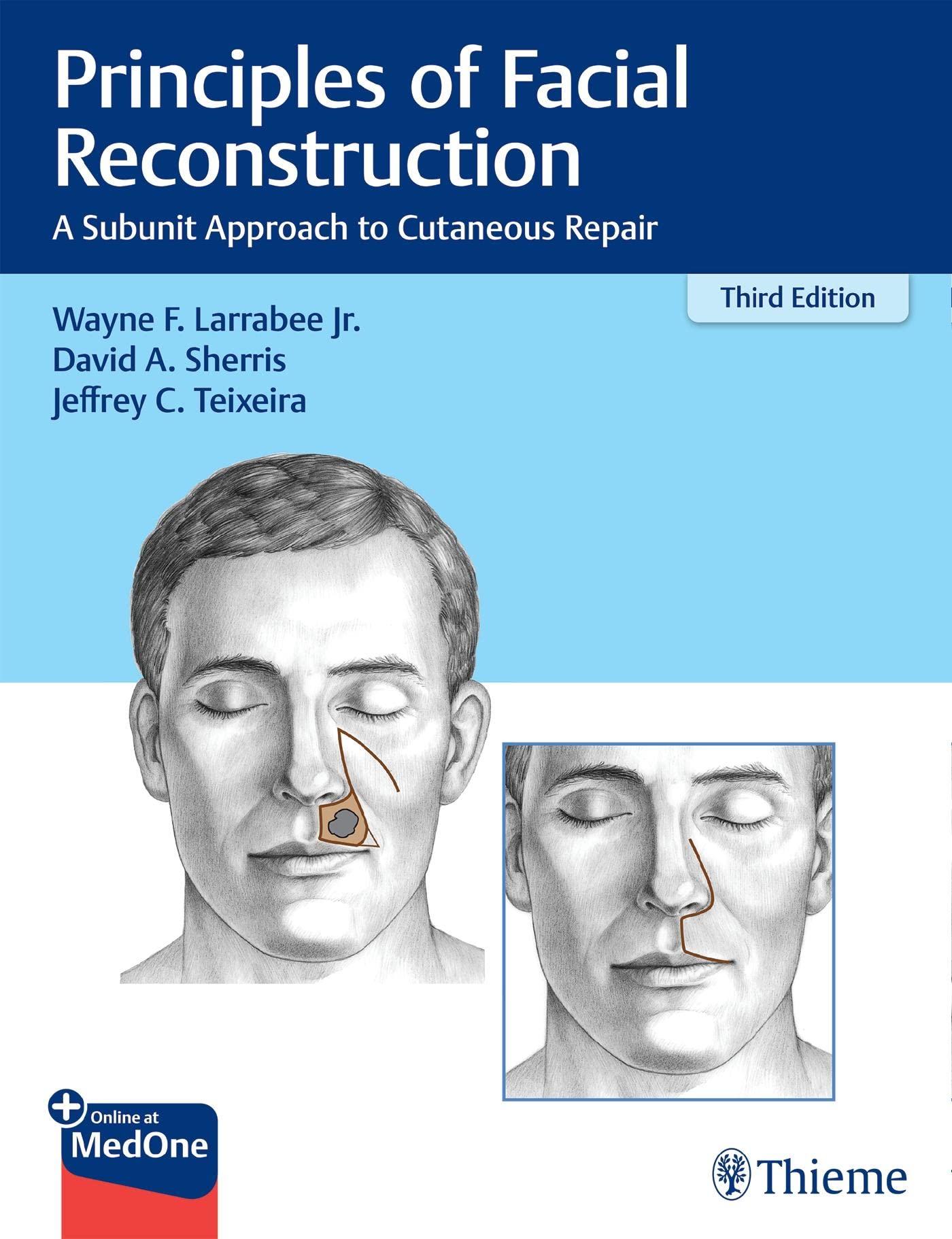 Principles of Facial Reconstruction: A Subunit Approach to Cutaneous Repair [Hardcover] Larrabee, Wayne F.; Sherris, David A. and Teixeira, Jeffrey