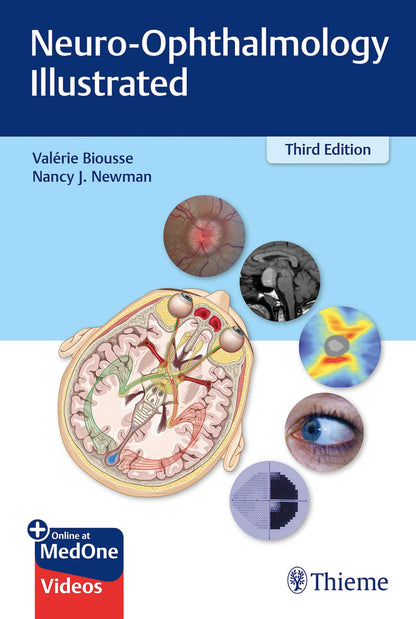 Neuro-Ophthalmology Illustrated [Paperback] Biousse, Valerie and Newman, Nancy