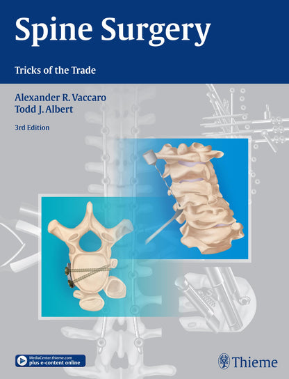 Spine Surgery: Tricks of the Trade (Hardcover)
