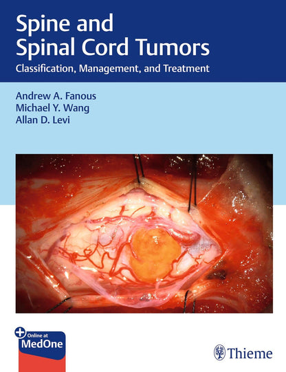 Spine and Spinal Cord Tumors: Classification, Management, and Treatment [Hardcover] Fanous, Andrew; Wang, Michael and Levi, Allan