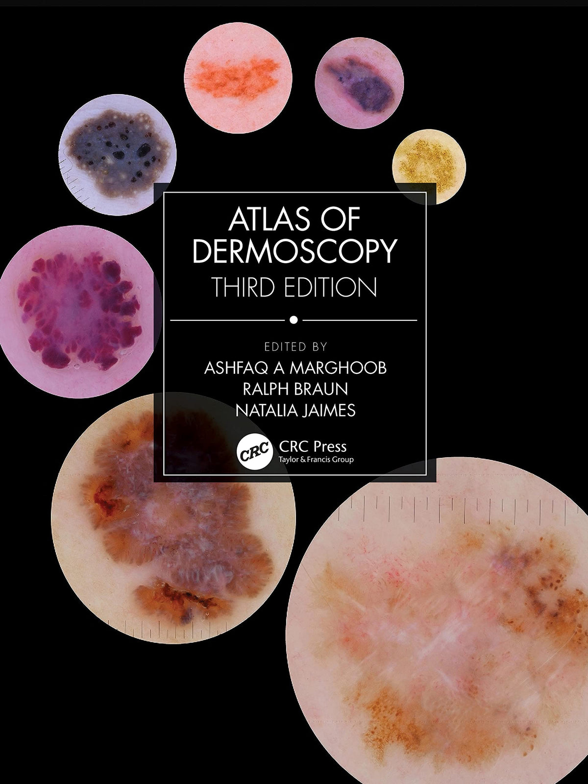 Atlas of Dermoscopy — Third Edition (Hardcover)