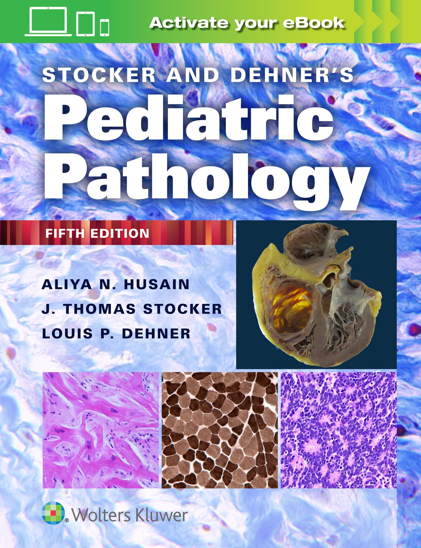 Stocker and Dehner's Pediatric Pathology [Hardcover] Husain MD, Aliya N. and Dehner MD, Louis P.