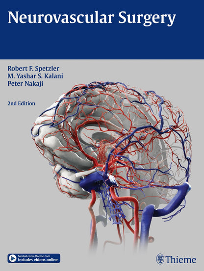 Neurovascular Surgery [Hardcover] Spetzler, Robert F.; Kalani, M. Yashar and Nakaji, Peter