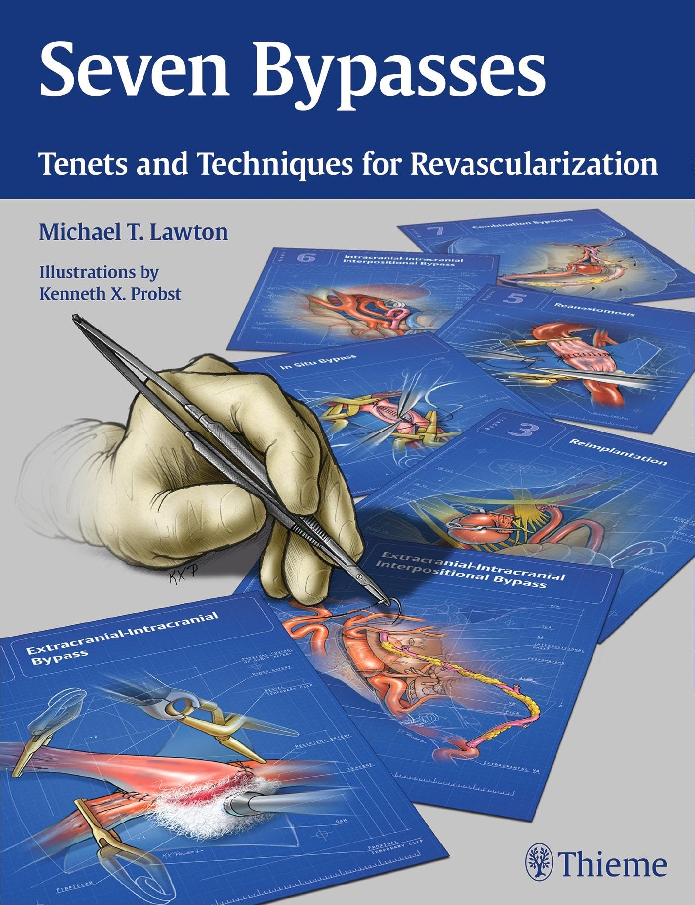 Seven Bypasses: Tenets and Techniques for Revascularization (Hardcover)