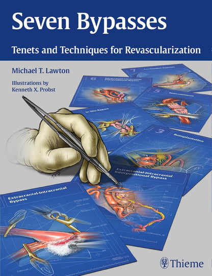 Seven Bypasses: Tenets and Techniques for Revascularization (Hardcover)