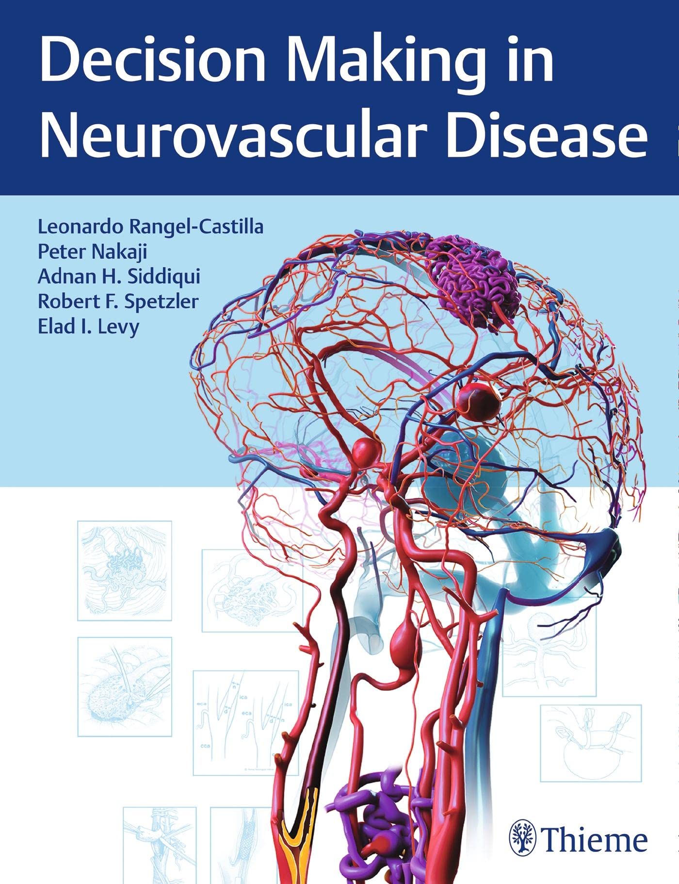 Decision Making in Neurovascular Disease [Hardcover] Rangel-Castilla, Leonardo; Nakaji, Peter; Siddiqui, Adnan H.; Spetzler, Robert F. and Levy, Elad I.